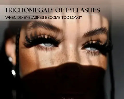 Can eyelashes be too long? – Trichomegaly and eyelash styling